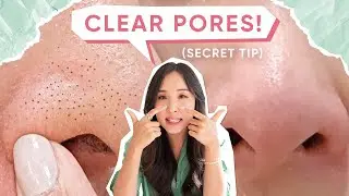 My *no fail* Routine for BLACKHEADS, LARGE PORES & ACNE!👌