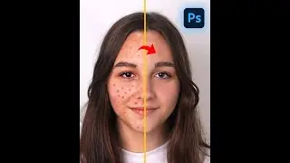 Skin retouching   Photoshop