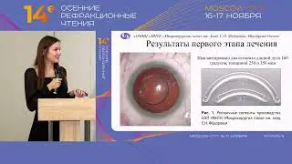 Реабилитация пациента с нерегулярным астигматизмом и миопией высокой степени