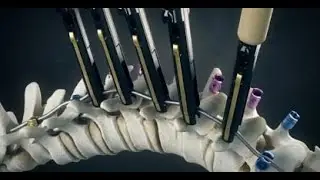 Medical Animation Showreel - Austin Visuals