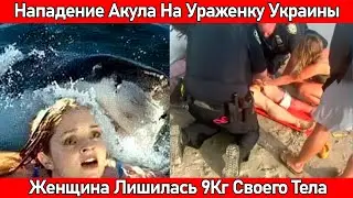 NEWS❗Shark Attacked Ukrainian Woman in New York, USA❗Woman Lost 9Kg of Her Body❗August 7❗
