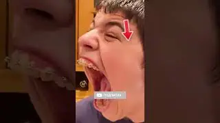 Самый Большой Рот в Мире! 