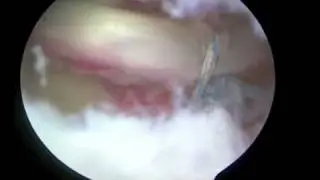 Hip Dynamic Examination