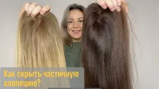 Как скрыть частичную алопецию с помощью накладки?