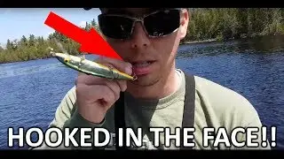 HOOKED IN THE FACE! Be careful with Jerkbaits!!