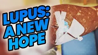 Living with Lupus: A New Approach.