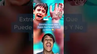 Extrañas Fobias Que Puede Que Tengas Y No Lo Sabes 😮 