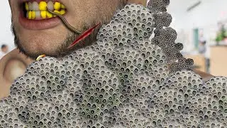 ASMR severley injured Neck treatment | ASMR removal clam infected Neck | ASMR 2d animation