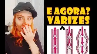 ADEUS VARIZES E VASINHOS EM SEGUNDOS