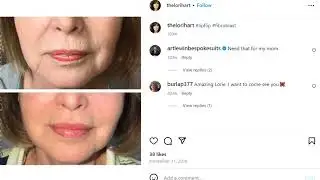 Lori's Ultimate Skin Treatments Breakdown