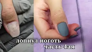 😨Это НЕЛЬЗЯ покрывать!❓/лопнул ноготь/ часть 4