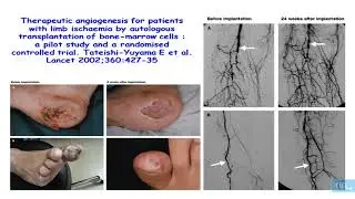 endothelium hémostase et angiogenese part4