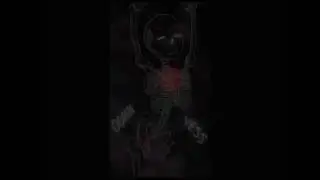 Frisk Check Up ~ Comic Dub {Undertale}