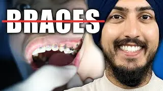 11 Ways to Ensure a Child NEVER Needs Braces