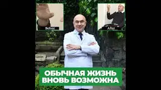 Глубокая стимуляция мозга (DBS). Проф. Али Цирх. Результаты 