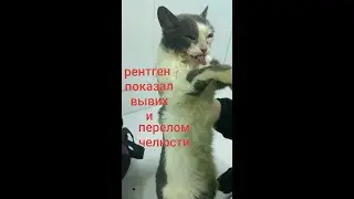 ВЫВИХ И ПЕРЕЛОМ ЧЕЛЮСТИ