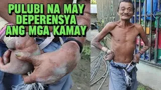 PULUBI NA MAY DEPERESYA ANG MGA KAMAY, NASAAN NA KAYA MGA PAMILYA NYA #homeless
