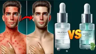 Salicylic Acid vs Glycolic Acid : Which One Is Better For Skin Health | Physiomedics