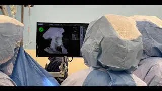 Robotic-Assisted Joint Replacements