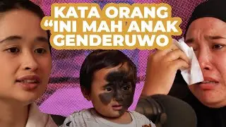 TANDA LAHIR HITAM SETENGAH MUKA! ORANG BILANG ANAK GENDERUWO #GritteBukaPraktek