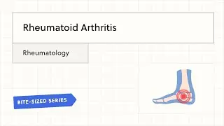 Rheumatoid Arthritis