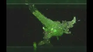 Artemia Salina (z-stack): Light sheet fluorescence microscopy [LSFM, SPIM]