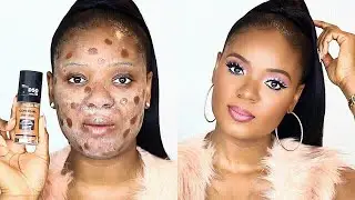 LIFE CHANGING! NATURAL AFFORDABLE MAKEUP FOR PROBLEM SKIN | OMABELLETV