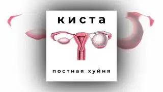Постная Хуйня - Остопиздели