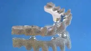 The Implant Restoration Specialists - PREAT Corp.