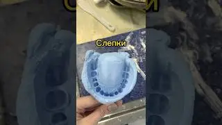 Почему люди боятся стоматологов? 