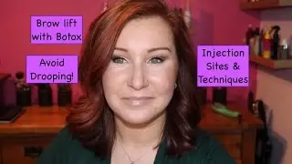 Brow Lift with Botox (Hooded Eyes) - Where to get Injections &  Avoiding Droop!