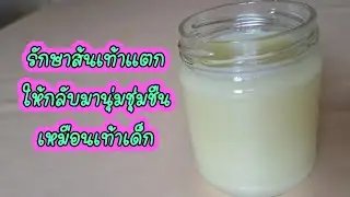 รักษาส้นเท้าแตก cracked heel treatment #ทำครีมใช้เอง #ส้นเท้าแตก