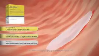 Ролик Де-Нол