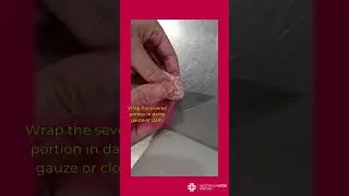 What to do if you cut off a finger!