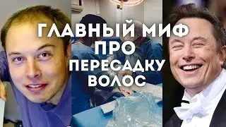 ЧТО СКРЫВАЮТ ПРО ПЕРЕСАДКУ ВОЛОС? | ПЕРЕСАДКА ВОЛОС | ПЕРЕСАДКА ВОЛОС В ТУРЦИИ
