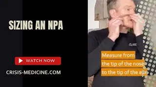 Sizing an NPA