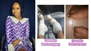 My First Surgery: My Most Painful Experience So Far - #StoryTime