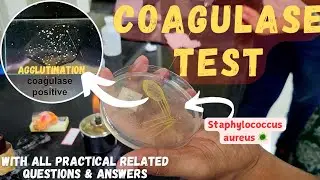 Coagulase Test | Microbiology Practical  | Related All Q&As | The Chill Medico
