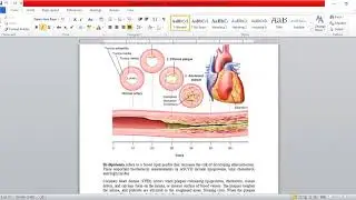 Cardiovascular Diseases