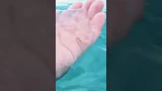 медузы напали на отдыхающих !!!!