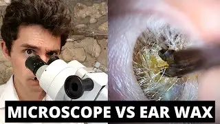 Microscope VS Ear Wax