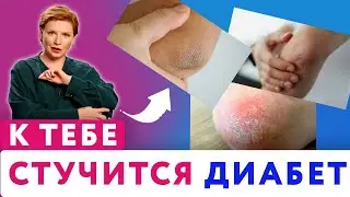 Why are elbows dry and rough? // Causes of dry elbows