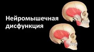 НЕЙРОМЫШЕЧНАЯ ДИСФУНКЦИЯ