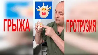 Грыжа позвоночника и протрузия. В чём разница?