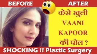 कैसे खुली Vaani Kapoor की Plastic Surgery की Poll? | Vaani Kapoor Plastic Surgery