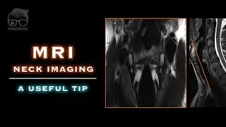 MRI – NECK IMAGING – A USEFUL TIP