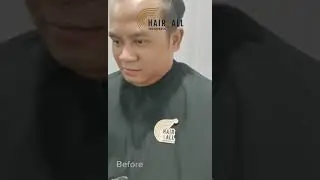 Solusi Kebotakan Pria