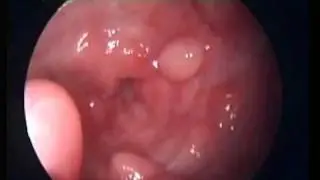 mioma vagina dog