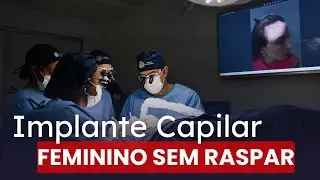 TRANSPLANTE CAPILAR Feminino SEM RASPAR