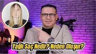 Yağlı Saç Neden Olur? Sebepleri ve Çözüm Önerileri!